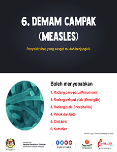 Demam Campak(Measles) - infografik 6